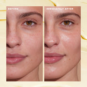 Before and after image of skin
