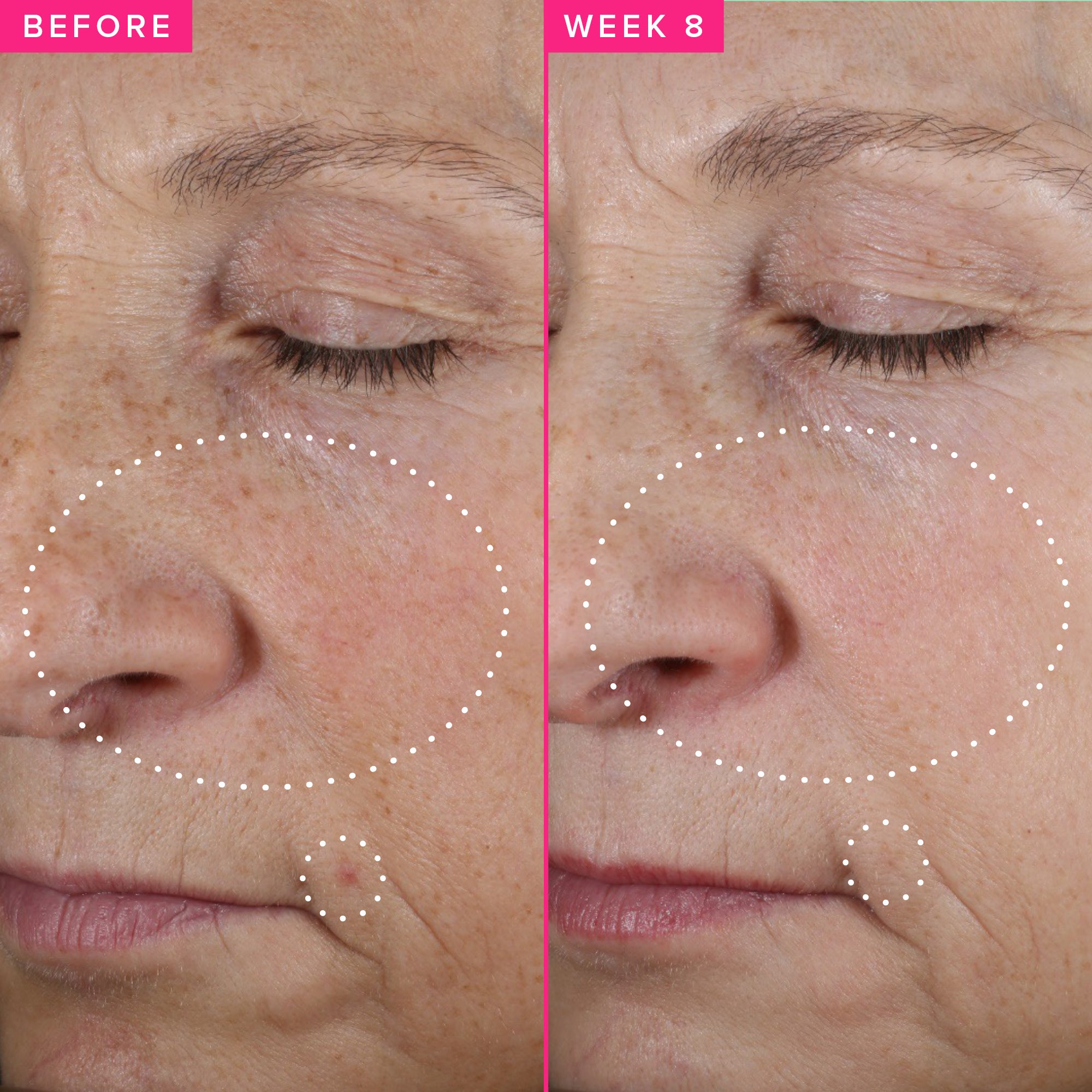 Brighten Up 3% TXA Brightening Toner | Farmacy Beauty