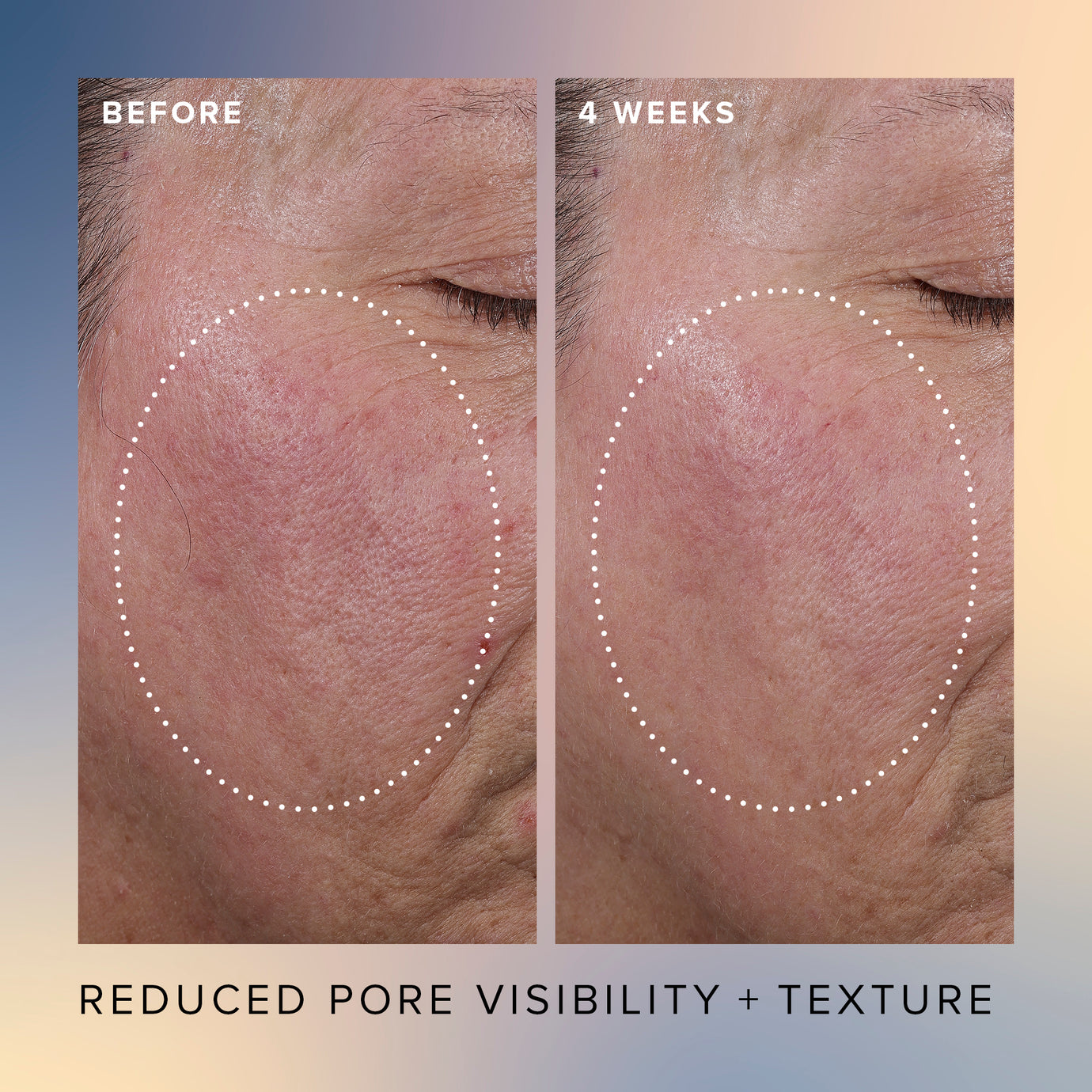 Honey Glow 17% AHA + BHA Resurfacing Acid Serum