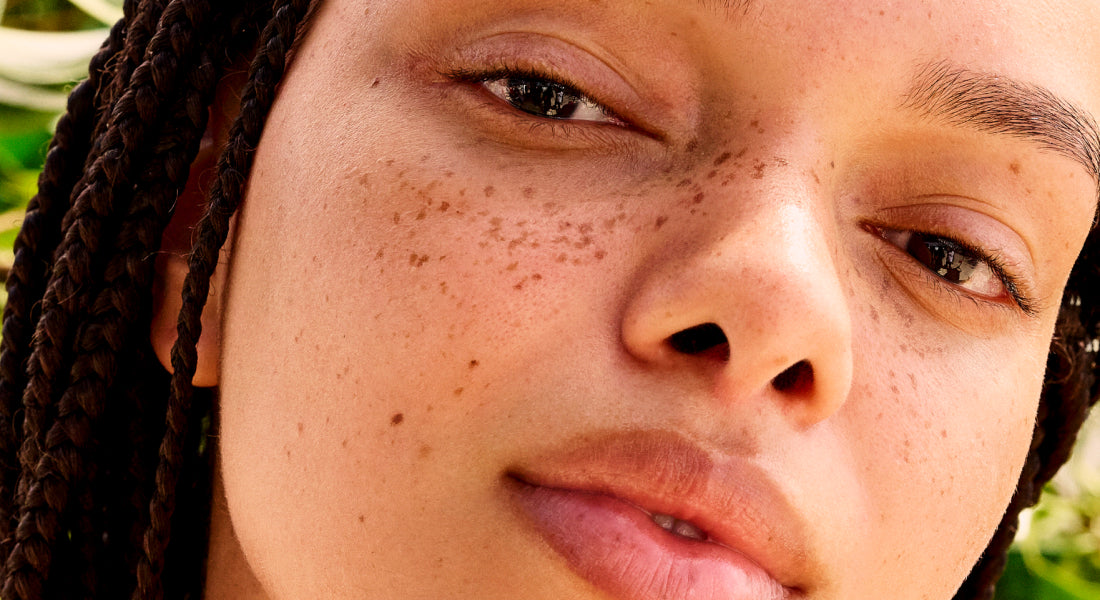 Close-up of a person's face with freckles and braided hair.