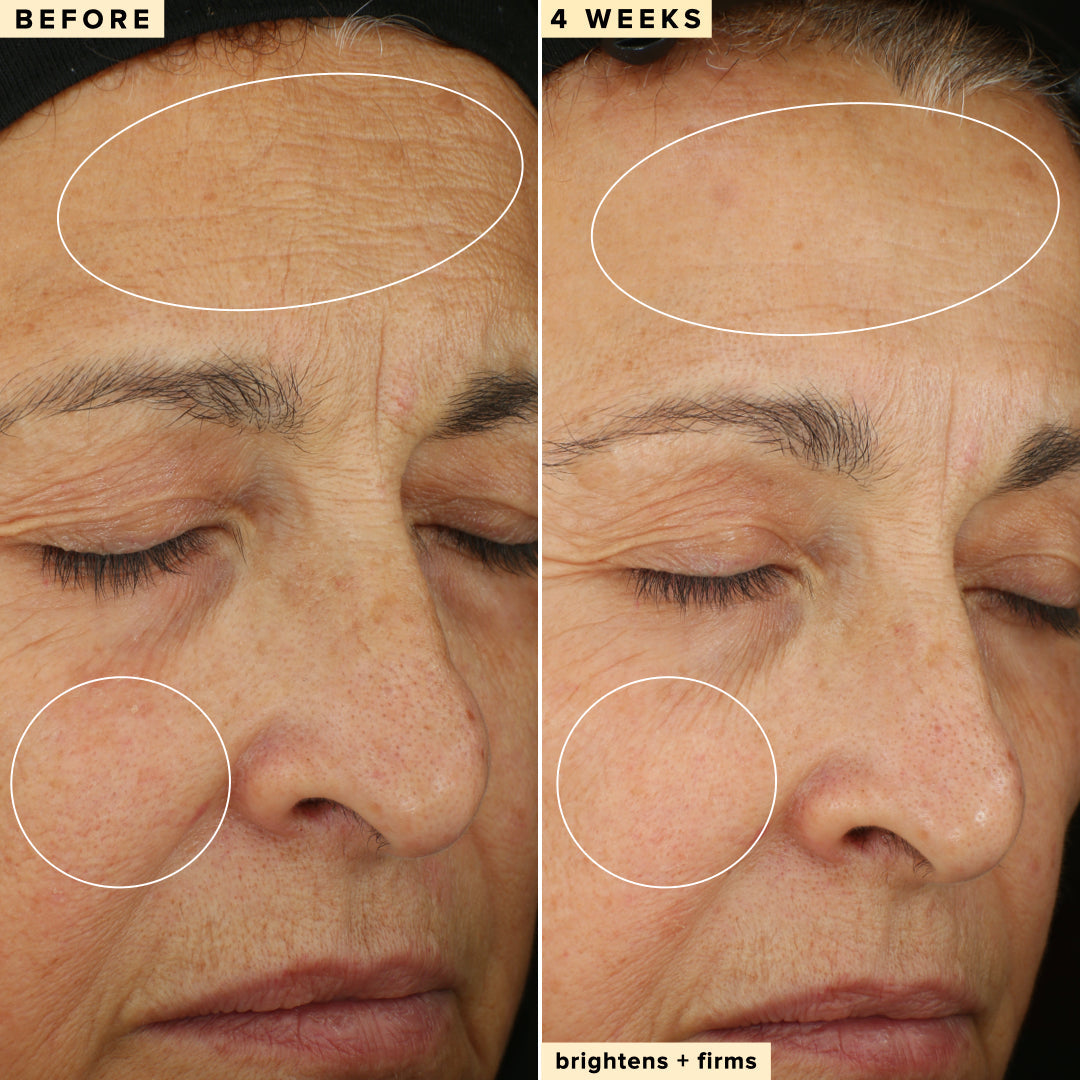 Close up of a woman's face before and after applying the 10% Waterless Vitamin C Serum to her face