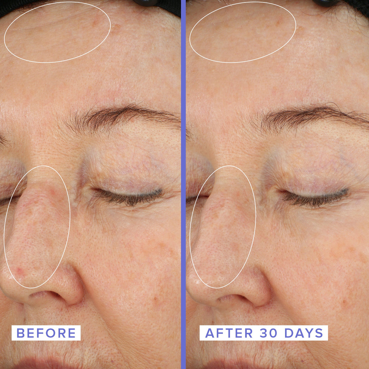 Close up of a woman's face before and after applying the 10% Niacinamide Night Mask to her face