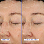 Close up of a woman's face before and after applying the 10% Niacinamide Night Mask to her face